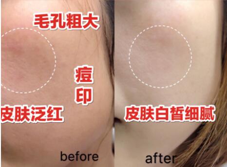 丽普司肽和欧莉典雅 暨南大学欧莉典雅